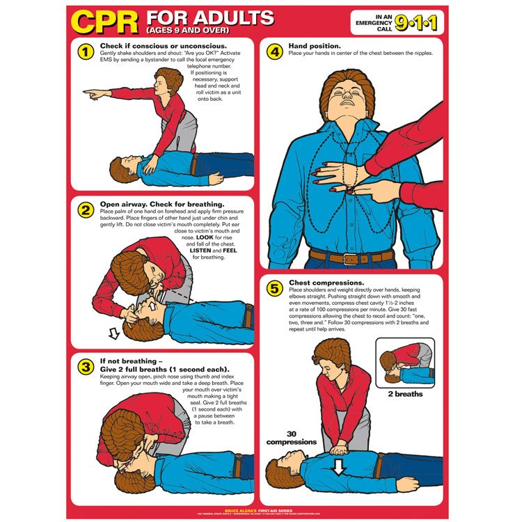 P3K Persiapan dan Teknik CPR (Nafas Buatan) detikLife